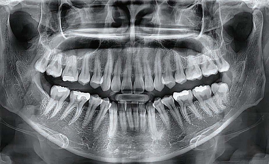 Smart Plus Vatech UK