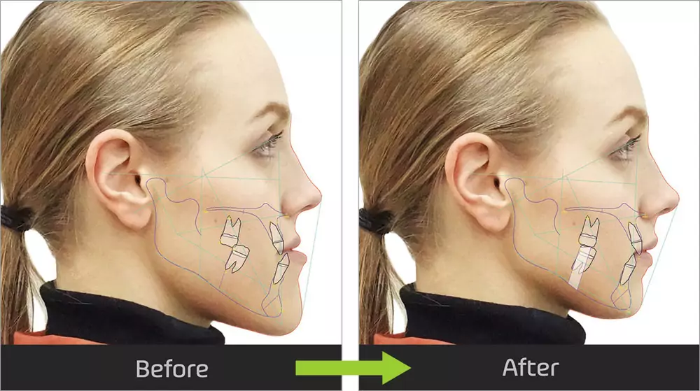 Morphing and Comparing